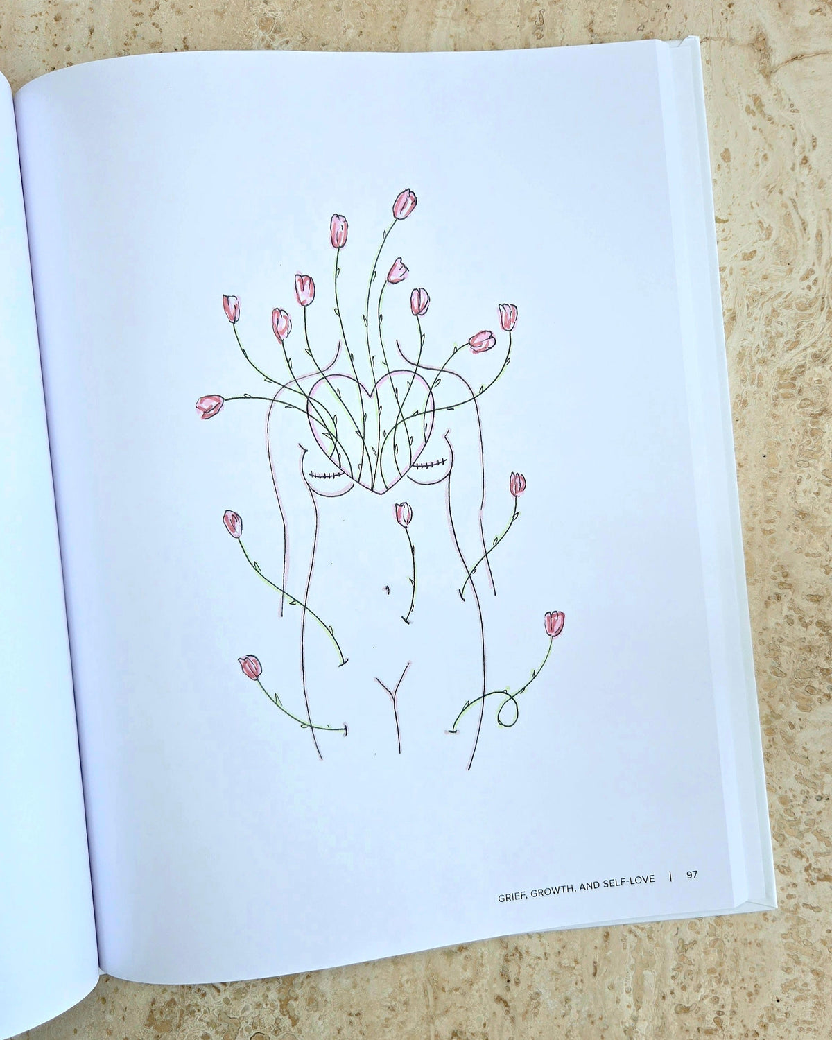 Lifectomy Illustrated Memoir PREORDER