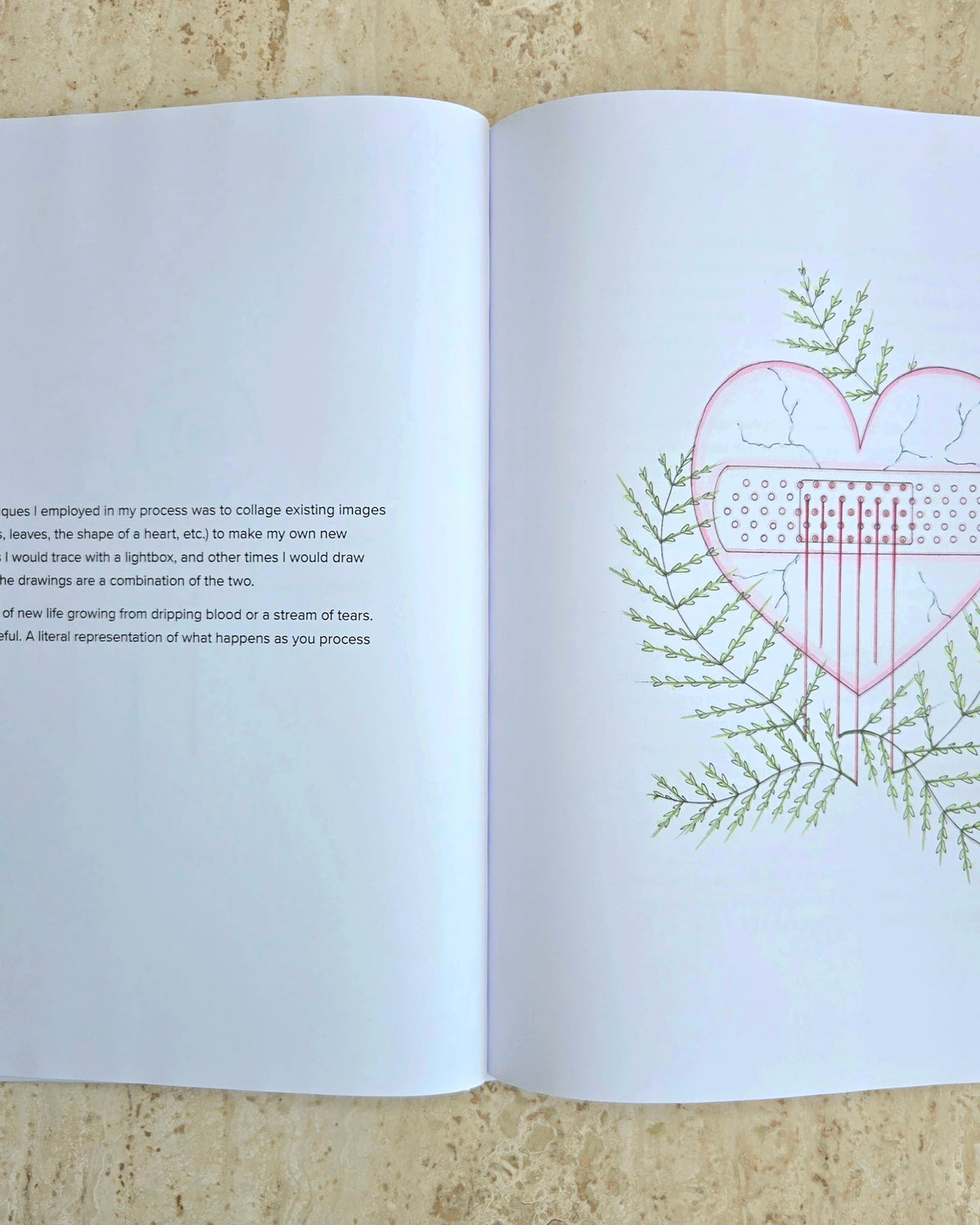 Lifectomy Illustrated Memoir PREORDER