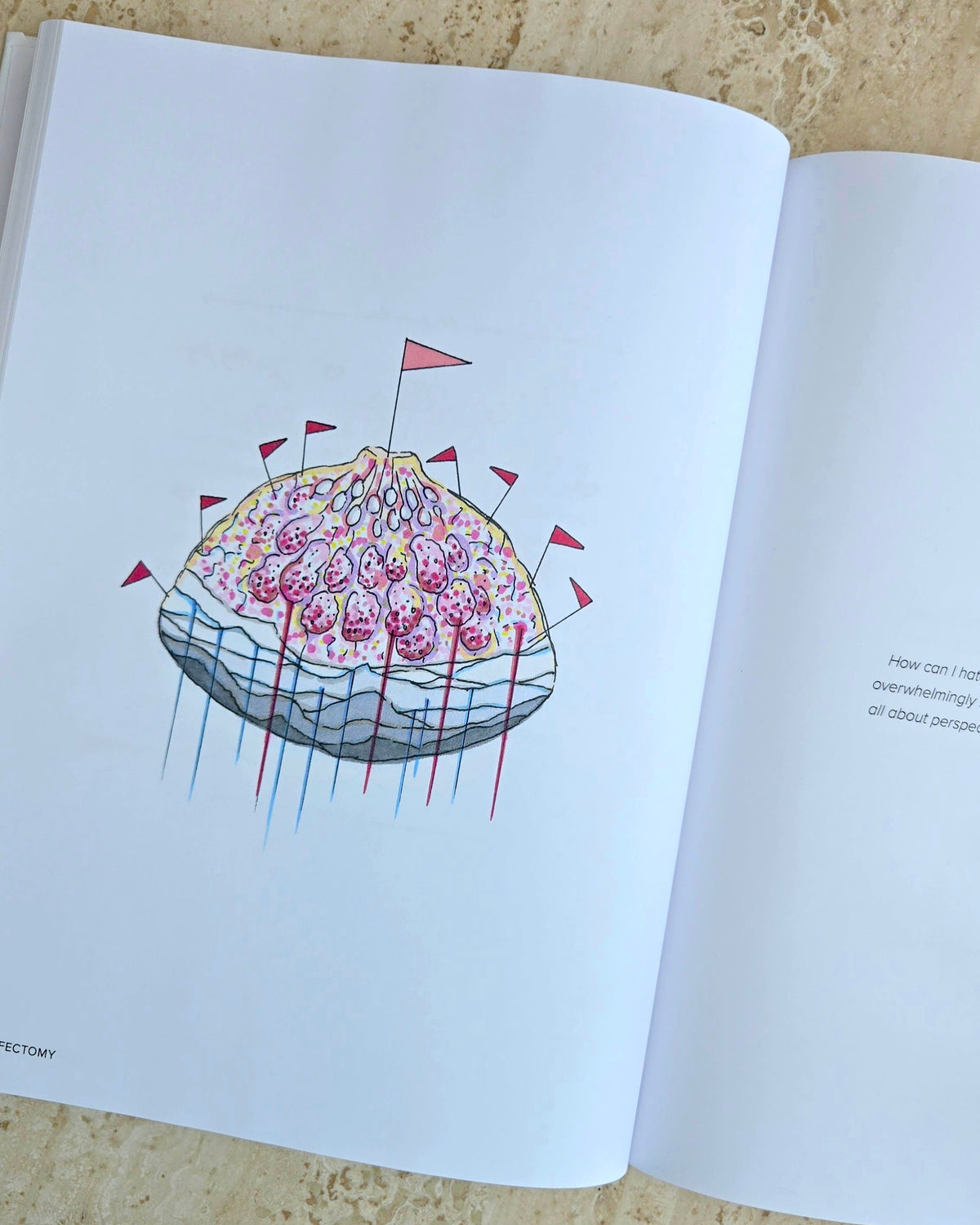 Lifectomy Illustrated Memoir PREORDER